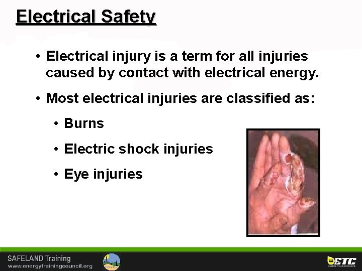 Electrical Safety • Electrical injury is a term for all injuries caused by contact