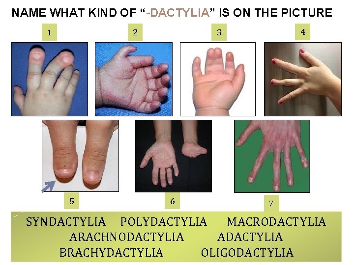 NAME WHAT KIND OF “-DACTYLIA” IS ON THE PICTURE 1 2 5 4 3