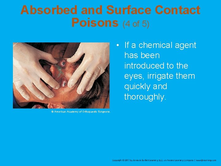 Absorbed and Surface Contact Poisons (4 of 5) • If a chemical agent has