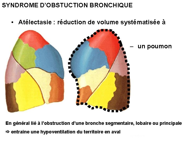 SYNDROME D’OBSTUCTION BRONCHIQUE • Atélectasie : réduction de volume systématisée à – un poumon