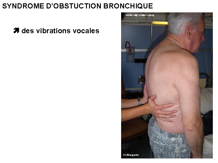 SYNDROME D’OBSTUCTION BRONCHIQUE des vibrations vocales 