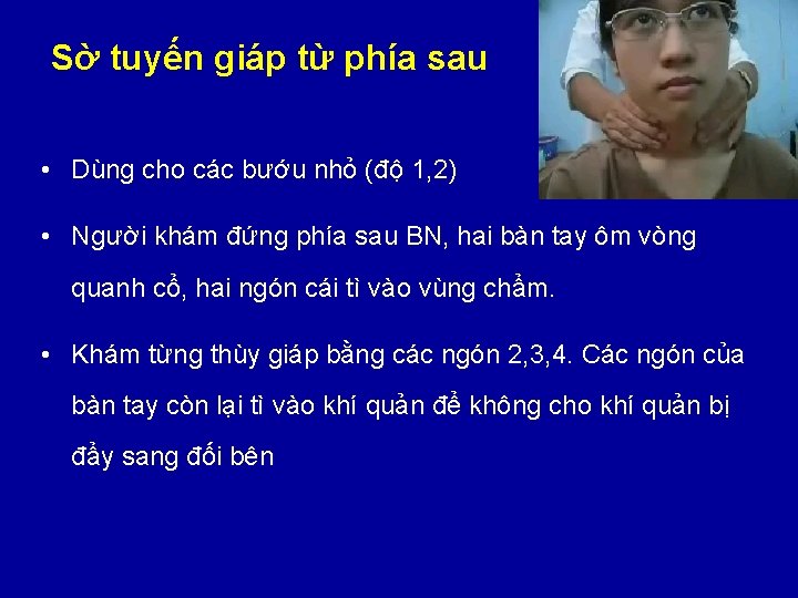 Sờ tuyến giáp từ phía sau • Dùng cho các bướu nhỏ (độ 1,