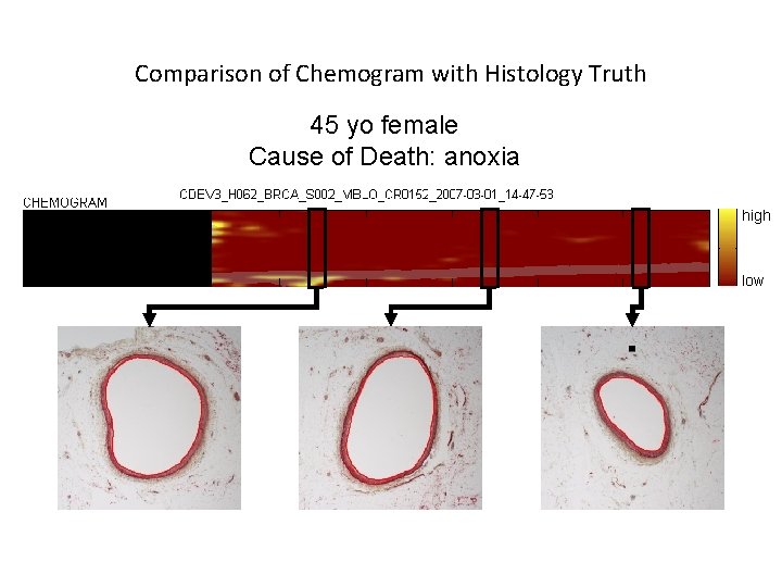 Comparison of Chemogram with Histology Truth 45 yo female Cause of Death: anoxia high