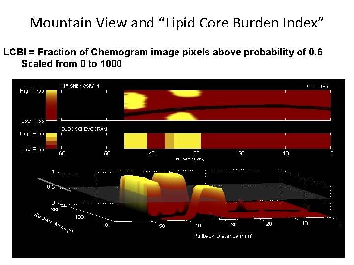 Mountain View and “Lipid Core Burden Index” LCBI = Fraction of Chemogram image pixels