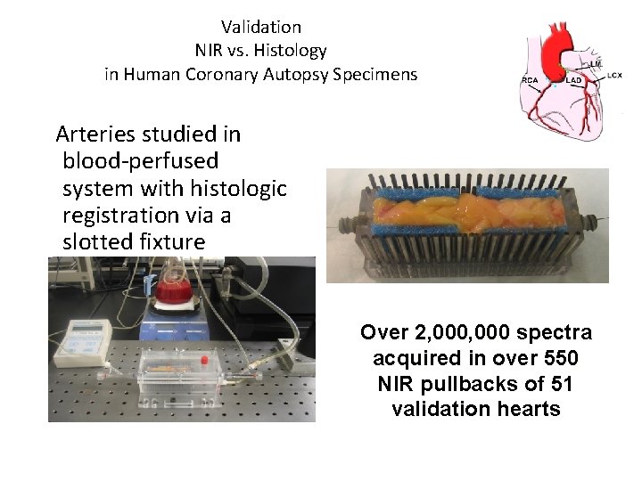 Validation NIR vs. Histology in Human Coronary Autopsy Specimens Arteries studied in blood-perfused system