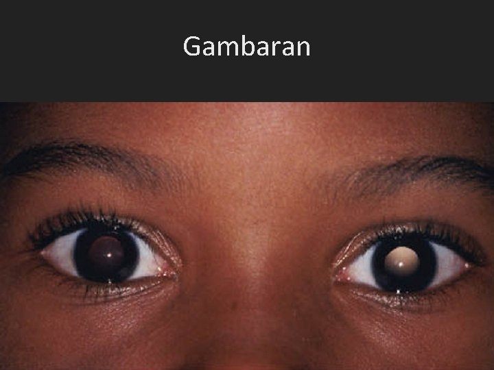 Gambaran Gambaran