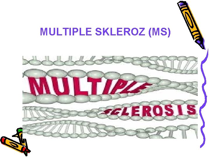 MULTIPLE SKLEROZ (MS) 