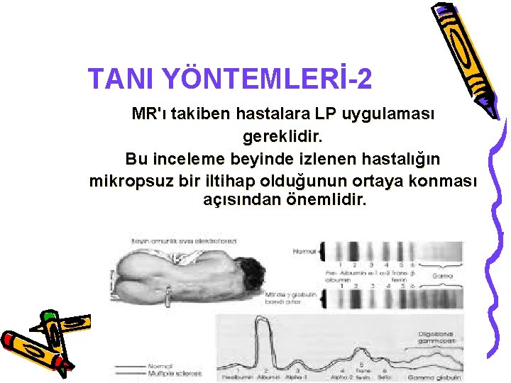 TANI YÖNTEMLERİ-2 MR'ı takiben hastalara LP uygulaması gereklidir. Bu inceleme beyinde izlenen hastalığın mikropsuz