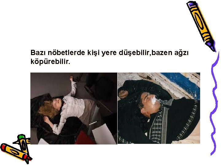 Bazı nöbetlerde kişi yere düşebilir, bazen ağzı köpürebilir. 