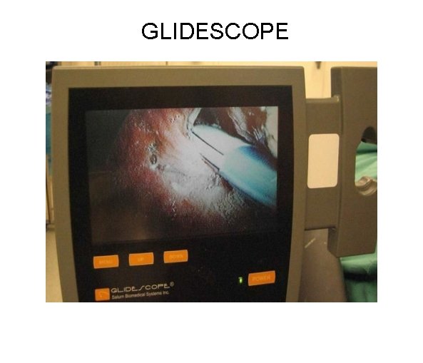 GLIDESCOPE 