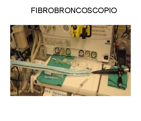 FIBROBRONCOSCOPIO 