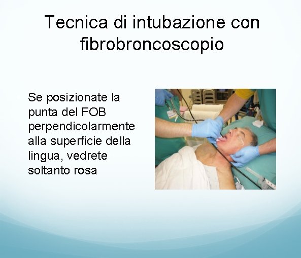 Tecnica di intubazione con fibrobroncoscopio • Se posizionate la punta del FOB perpendicolarmente alla