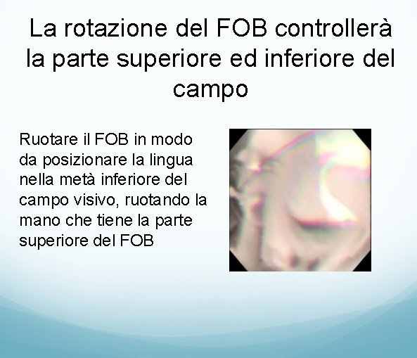 La rotazione del FOB controllerà la parte superiore ed inferiore del campo Ruotare il