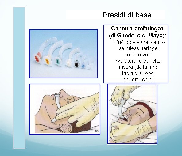 Presidi di base Cannula orofaringea (di Guedel o di Mayo): • Può provocare vomito