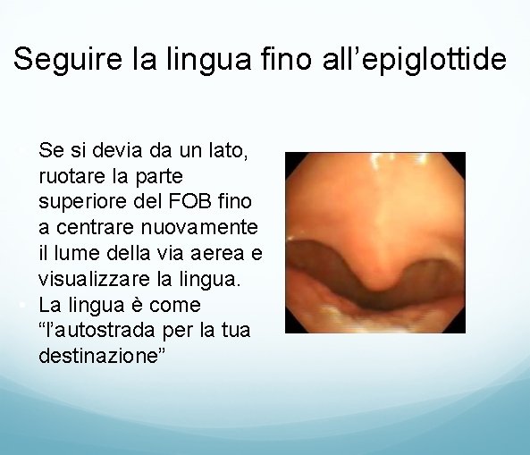 Seguire la lingua fino all’epiglottide • Se si devia da un lato, ruotare la