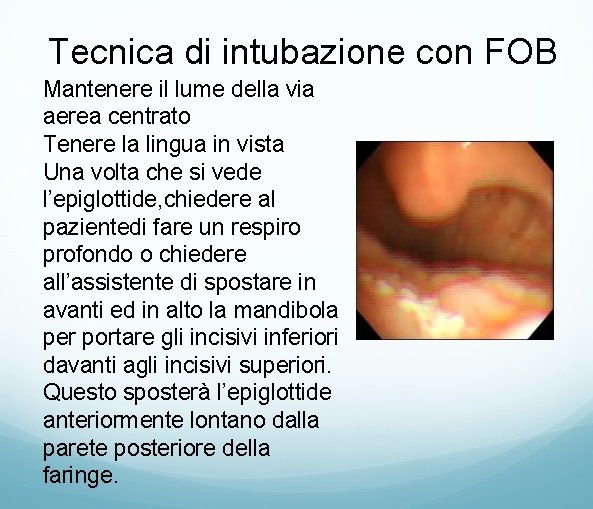 Tecnica di intubazione con FOB • Mantenere il lume della via aerea centrato •