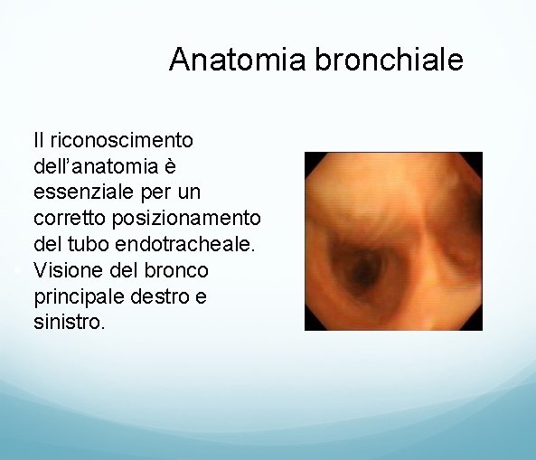 Anatomia bronchiale • Il riconoscimento dell’anatomia è essenziale per un corretto posizionamento del tubo