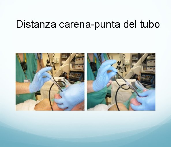 Distanza carena-punta del tubo 