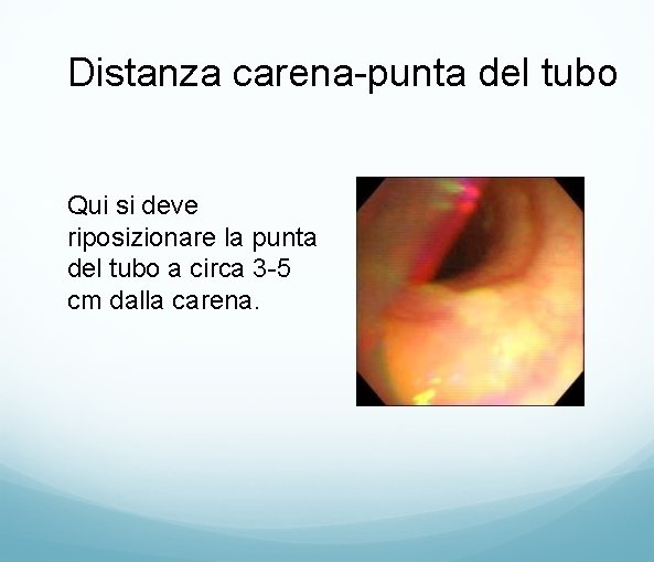 Distanza carena-punta del tubo • Qui si deve riposizionare la punta del tubo a