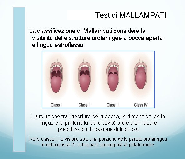 Test di MALLAMPATI La classificazione di Mallampati considera la visibilità delle strutture orofaringee a