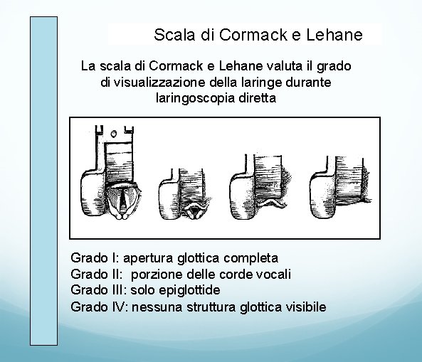 Scala di Cormack e Lehane La scala di Cormack e Lehane valuta il grado