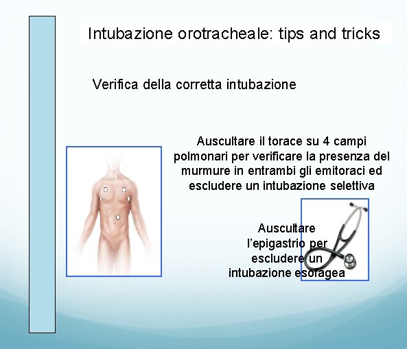 Intubazione orotracheale: tips and tricks Verifica della corretta intubazione Auscultare il torace su 4