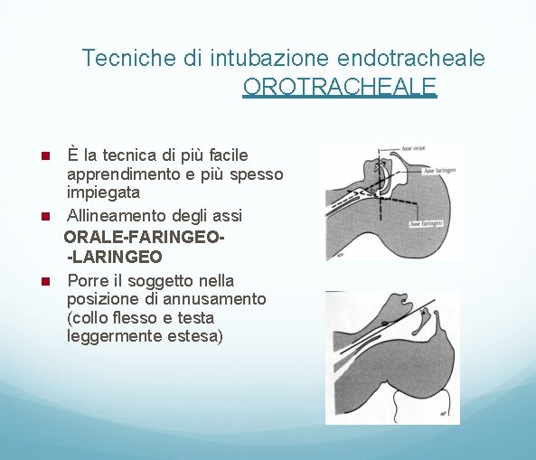 Tecniche di intubazione endotracheale OROTRACHEALE È la tecnica di più facile apprendimento e più