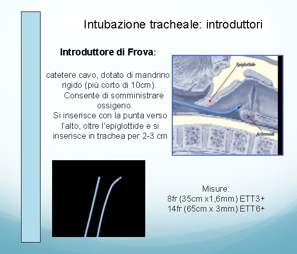 Intubazione tracheale: introduttori Introduttore di Frova: catetere cavo, dotato di mandrino rigido (più corto