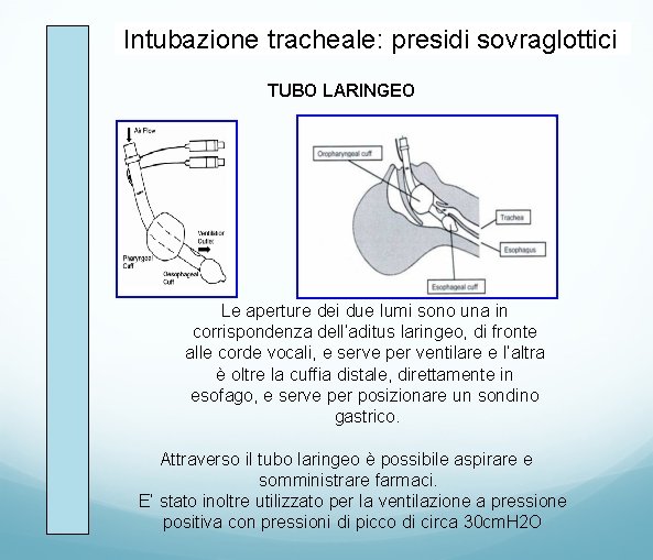 Intubazione tracheale: presidi sovraglottici TUBO LARINGEO Le aperture dei due lumi sono una in