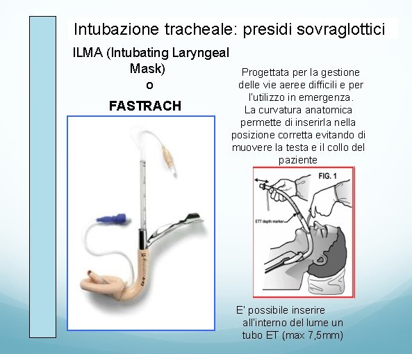 Intubazione tracheale: presidi sovraglottici ILMA (Intubating Laryngeal Mask) o FASTRACH H: Progettata per la