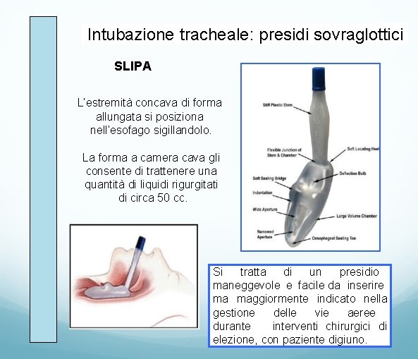 Intubazione tracheale: presidi sovraglottici SLIPA L’estremità concava di forma allungata si posiziona nell’esofago sigillandolo.