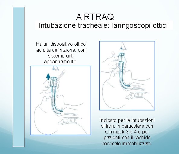 AIRTRAQ Intubazione tracheale: laringoscopi ottici Ha un dispositivo ottico ad alta definizione, con sistema