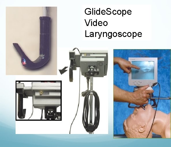 Glide. Scope Video Laryngoscope 