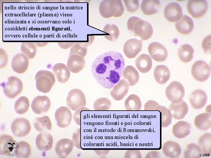 nello striscio di sangue la matrice extracellulare (plasma) viene eliminata e si osservano solo