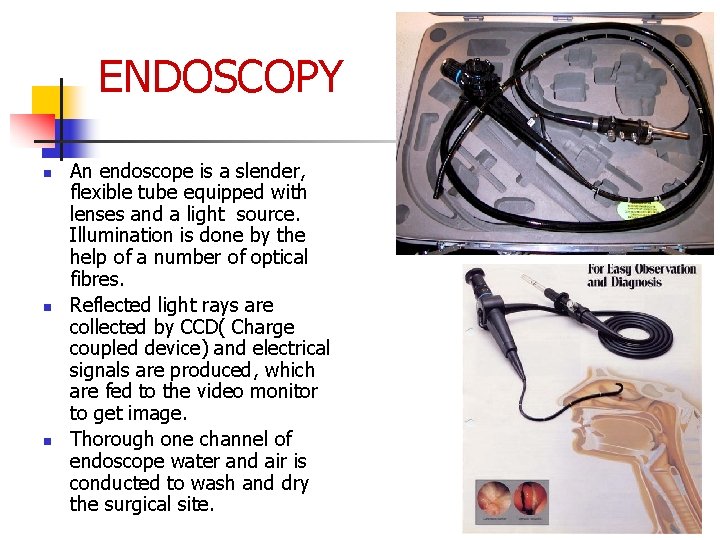 ENDOSCOPY n n n An endoscope is a slender, flexible tube equipped with lenses