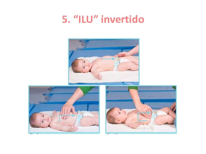 5. “ILU” invertido 