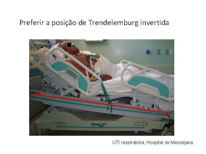 Preferir a posição de Trendelemburg invertida UTI respiratória, Hospital de Messejana 