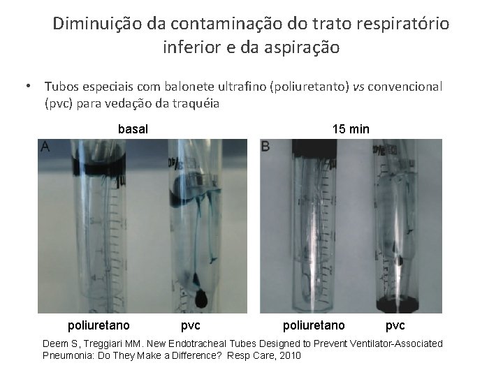 Diminuição da contaminação do trato respiratório inferior e da aspiração • Tubos especiais com