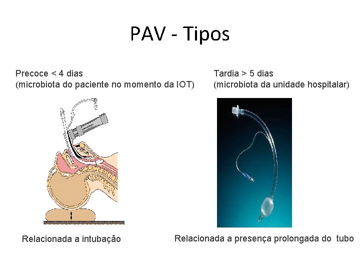 PAV - Tipos Precoce < 4 dias (microbiota do paciente no momento da IOT)
