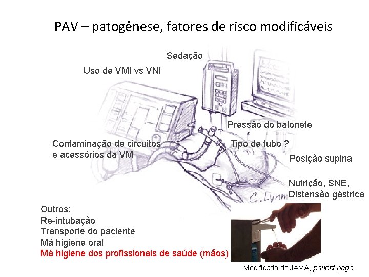 PAV – patogênese, fatores de risco modificáveis Sedação Uso de VMI vs VNI Pressão