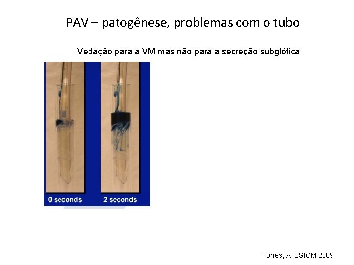 PAV – patogênese, problemas com o tubo Vedação para a VM mas não para