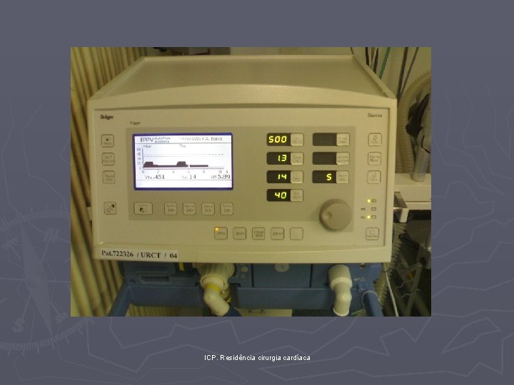 ICP. Residência cirurgia cardíaca 