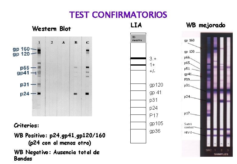 TEST CONFIRMATORIOS Western Blot LIA ID muestra 3. + 1+ +/gp 120 gp 41