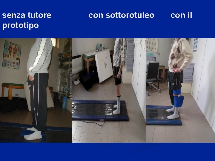 senza tutore prototipo con sottorotuleo con il 