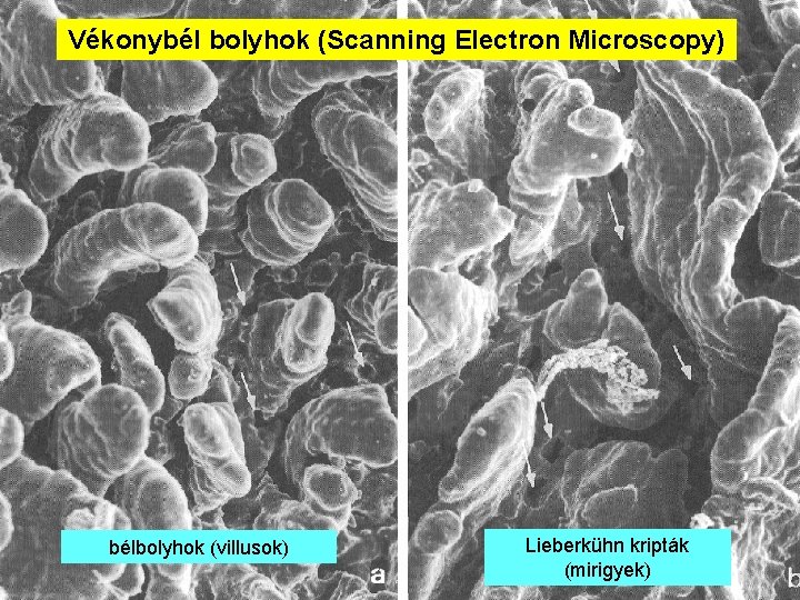 Vékonybél bolyhok (Scanning Electron Microscopy) bélbolyhok (villusok) Lieberkühn kripták (mirigyek) 