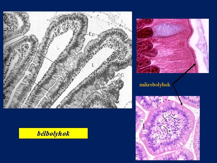 mikrobolyhok bélbolyhok 