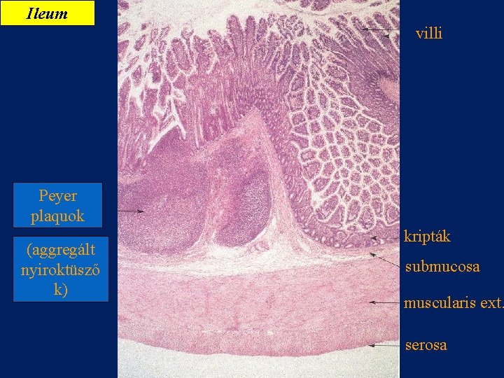 Ileum villi Peyer plaquok (aggregált nyiroktüsző k) kripták submucosa muscularis ext. serosa 