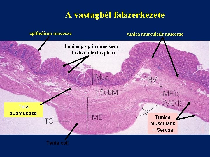 A vastagbél falszerkezete epithelium mucosae tunica muscularis mucosae lamina propria mucosae (+ Lieberkühn krypták)