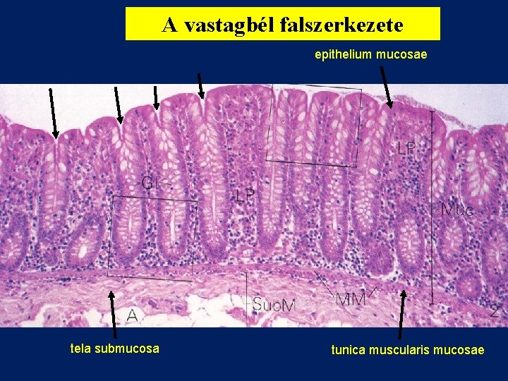 A vastagbél falszerkezete epithelium mucosae tela submucosa tunica muscularis mucosae 