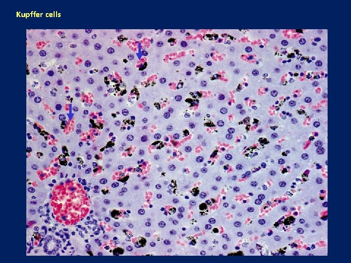 Kupffer cells 